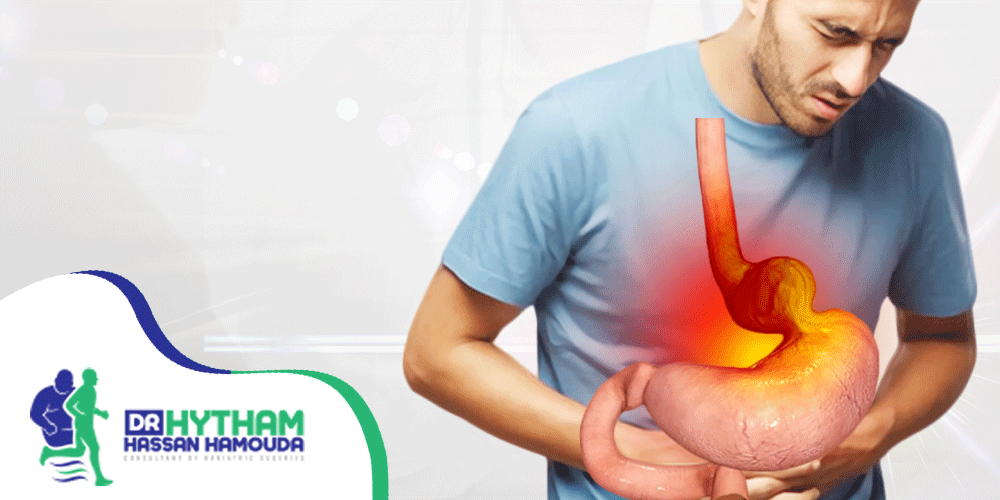 علاج فتق الحجاب الحاجز