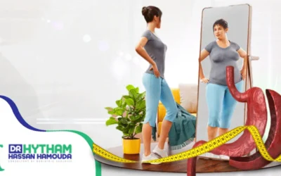 عملية تكميم المعدة بالمنظار